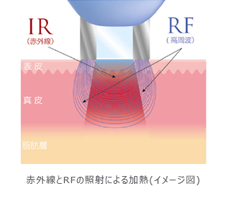 赤外線とRFの照射による加熱